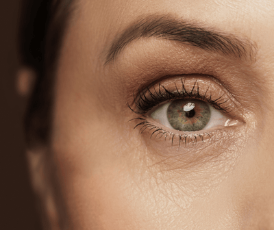 How to Get Rid of Bags and Dark Circles Under Eyes