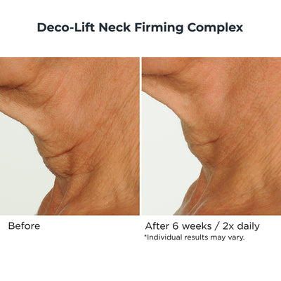 Eye & Neck Essentials Duo