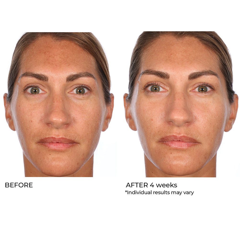 Even, Correct & Renew Retexturizing Pads - 30 Ct - NassifMD® Skincare