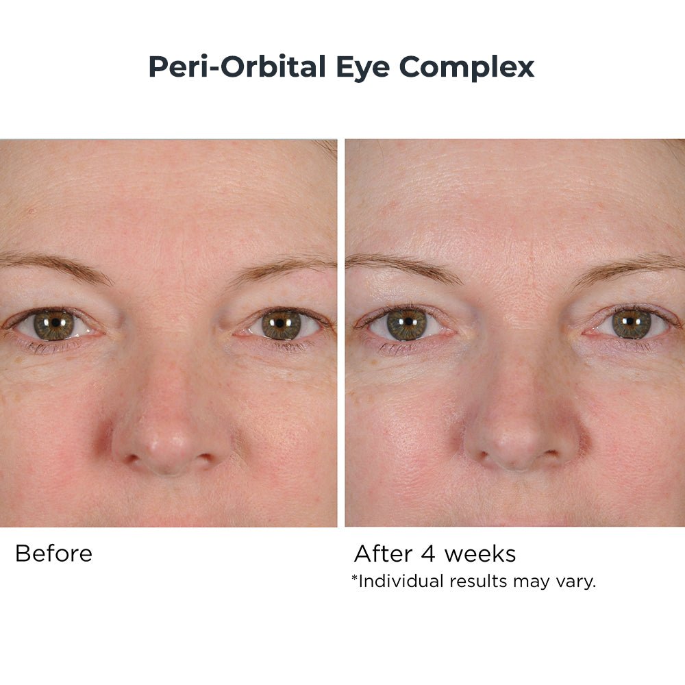 Eye & Neck Essentials Duo - NassifMD® Skincare