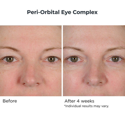 Eye & Neck Essentials Duo - NassifMD® Skincare