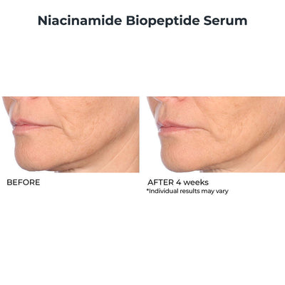 Firm & Smooth Targeted 3 Piece - NassifMD® Skincare