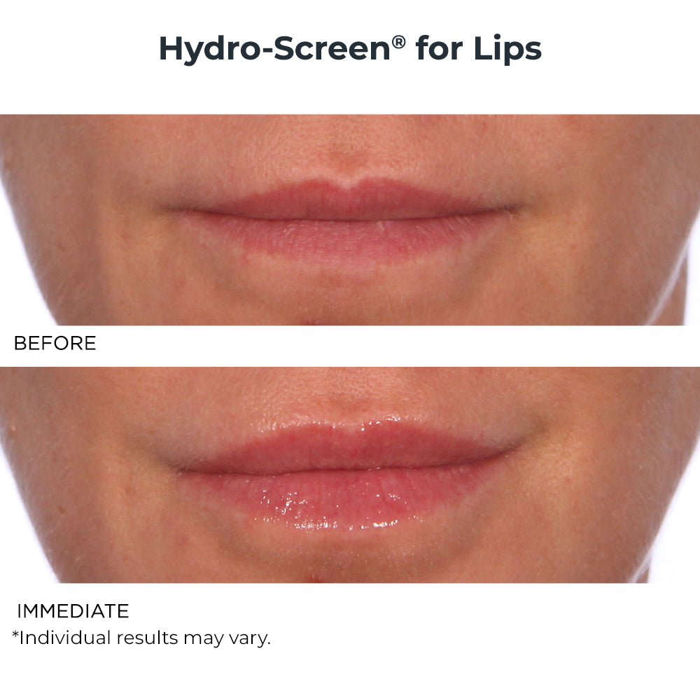 Hydro - Screen Lip Plumper & Lip Sugar Scrub Duo - NassifMD® Skincare