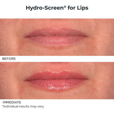 Hydro - Screen Lip Plumper & Lip Sugar Scrub Duo - NassifMD® Skincare