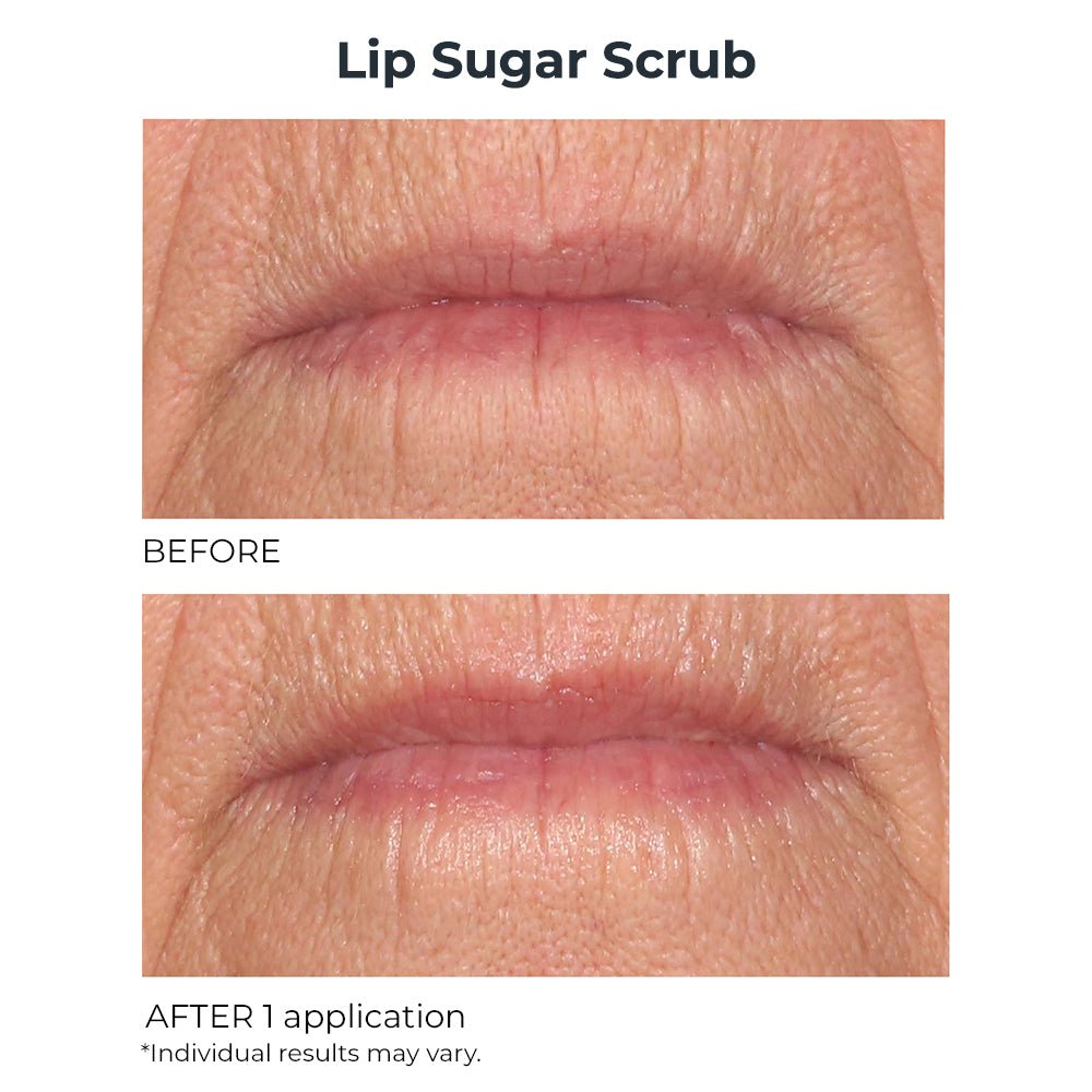 Hydro - Screen Lip Plumper & Lip Sugar Scrub Duo - NassifMD® Skincare