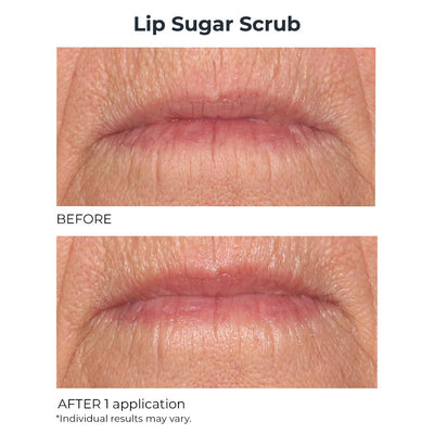 Hydro - Screen Lip Plumper & Lip Sugar Scrub Duo - NassifMD® Skincare