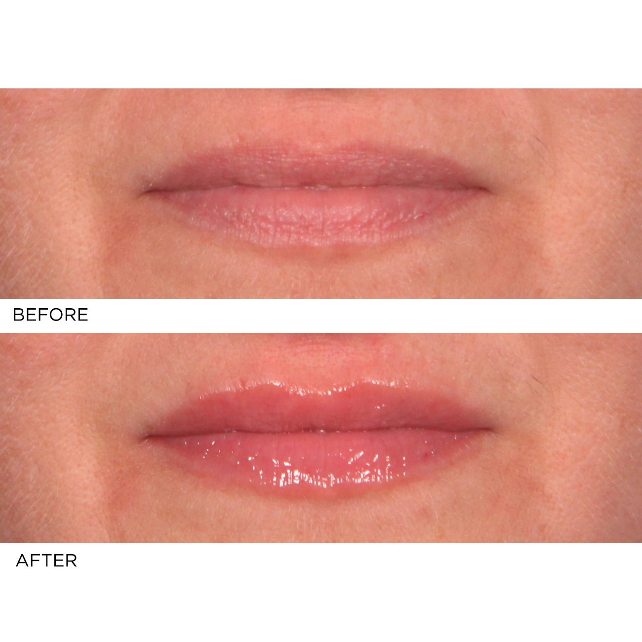 Hydro - Screen Lip Plumper - Pink Champagne - NassifMD® Skincare