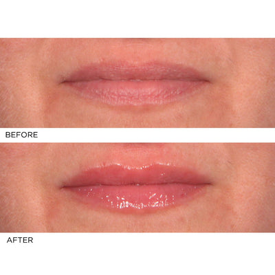 Hydro - Screen Lip Plumper - Pink Champagne - NassifMD® Skincare