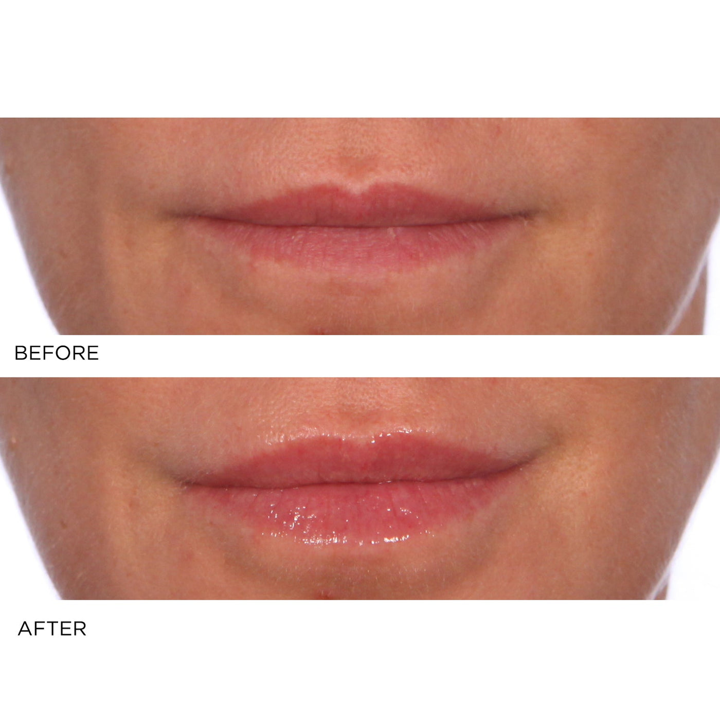Hydro - Screen Lip Plumper - Pink Champagne - NassifMD® Skincare