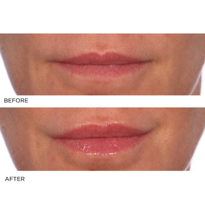 Hydro - Screen Lip Plumper - Pink Champagne - NassifMD® Skincare
