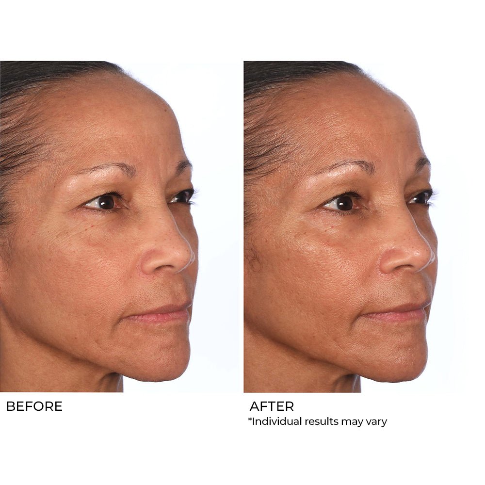 Instant Peptide Lift Face Sheet Mask - Single Use – NassifMD® Skincare