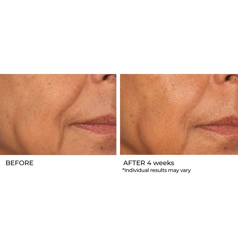 Niacinamide Biopeptide Serum 2oz | 60ml - NassifMD® Skincare
