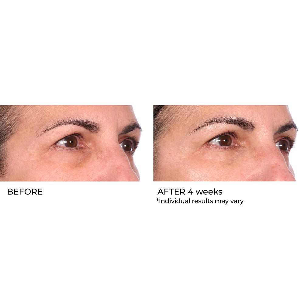 Niacinamide Biopeptide Serum 2oz | 60ml - NassifMD® Skincare