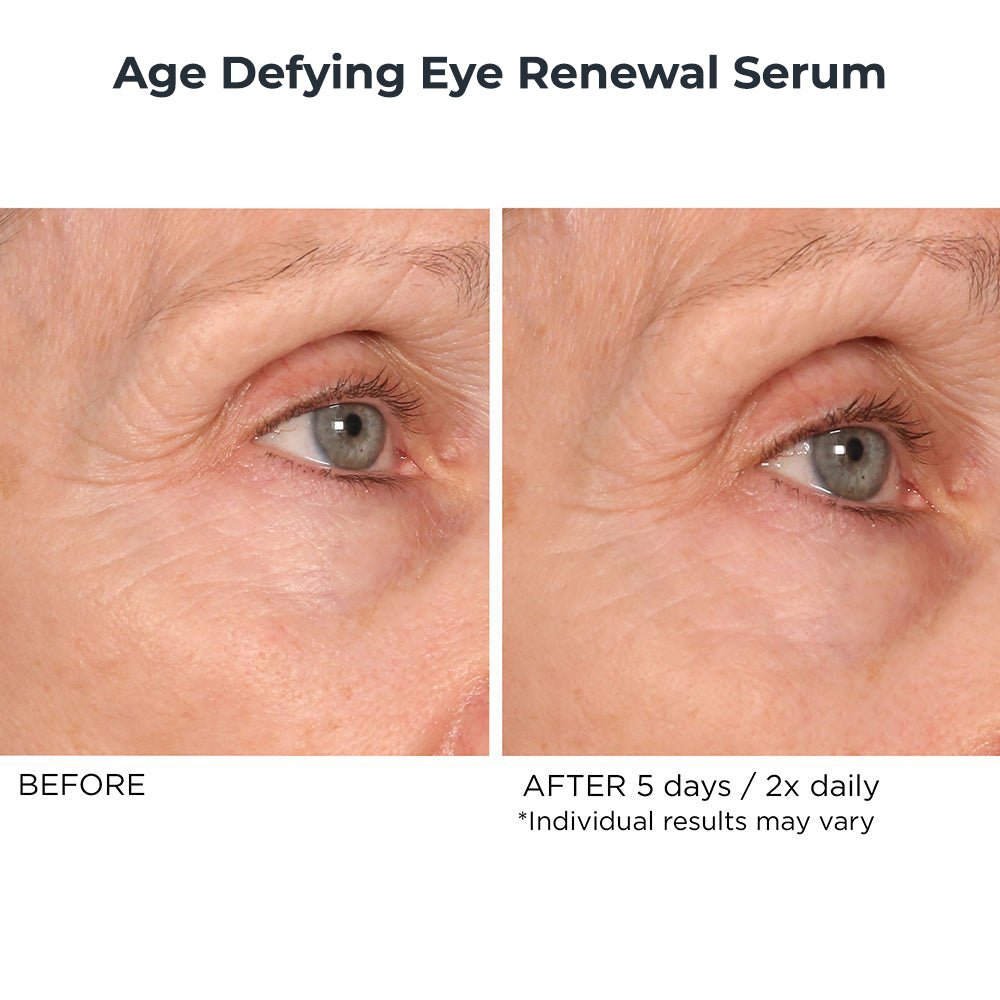 Nighttime Essentials 5 Piece - NassifMD® Skincare