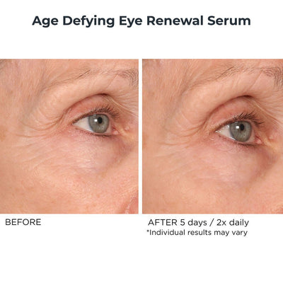 Nighttime Essentials 5 Piece - NassifMD® Skincare