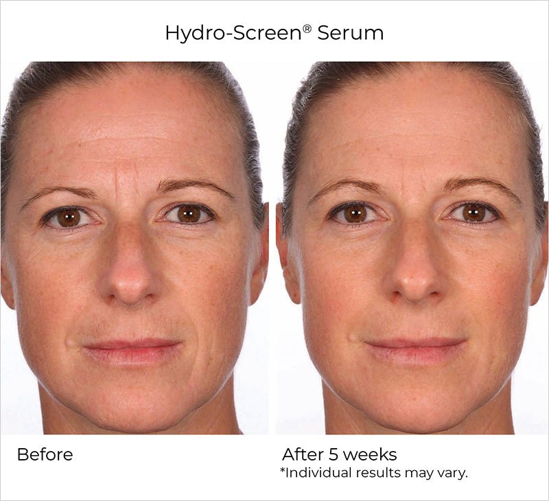 Nighttime Essentials 5 Piece - NassifMD® Skincare