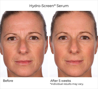 Nighttime Essentials 5 Piece - NassifMD® Skincare