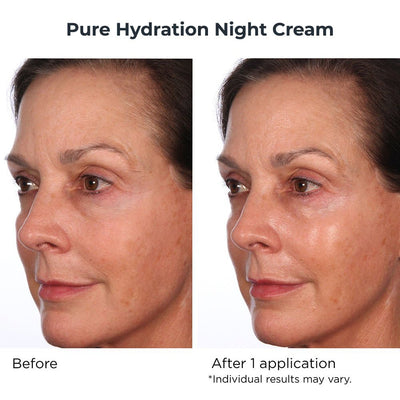 Nighttime Essentials 5 Piece - NassifMD® Skincare