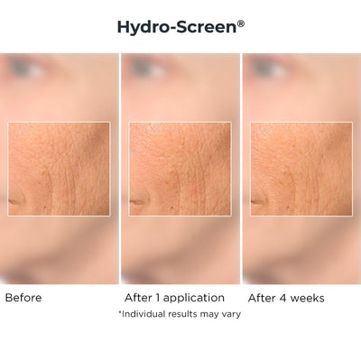 Pre Op Routine - Hydro-Screen