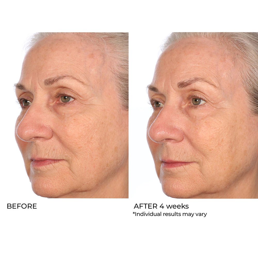 Pro Peptide Collagen Serum with Hyaluronic Acid - NassifMD® Skincare