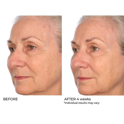 Collagen Serum Before and After Images