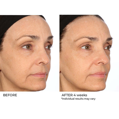 Pro Peptide Collagen Serum Before and After