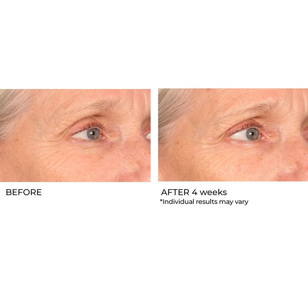 Pro Peptide Collagen Serum for Wrinkles