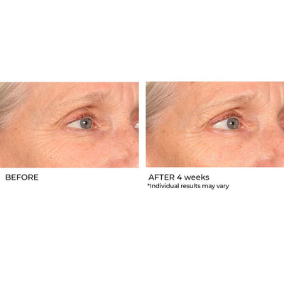 Pro Peptide Collagen Serum for Wrinkles