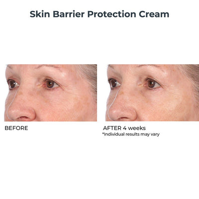 Skin Barrier Protection Cream - NassifMD® Skincare