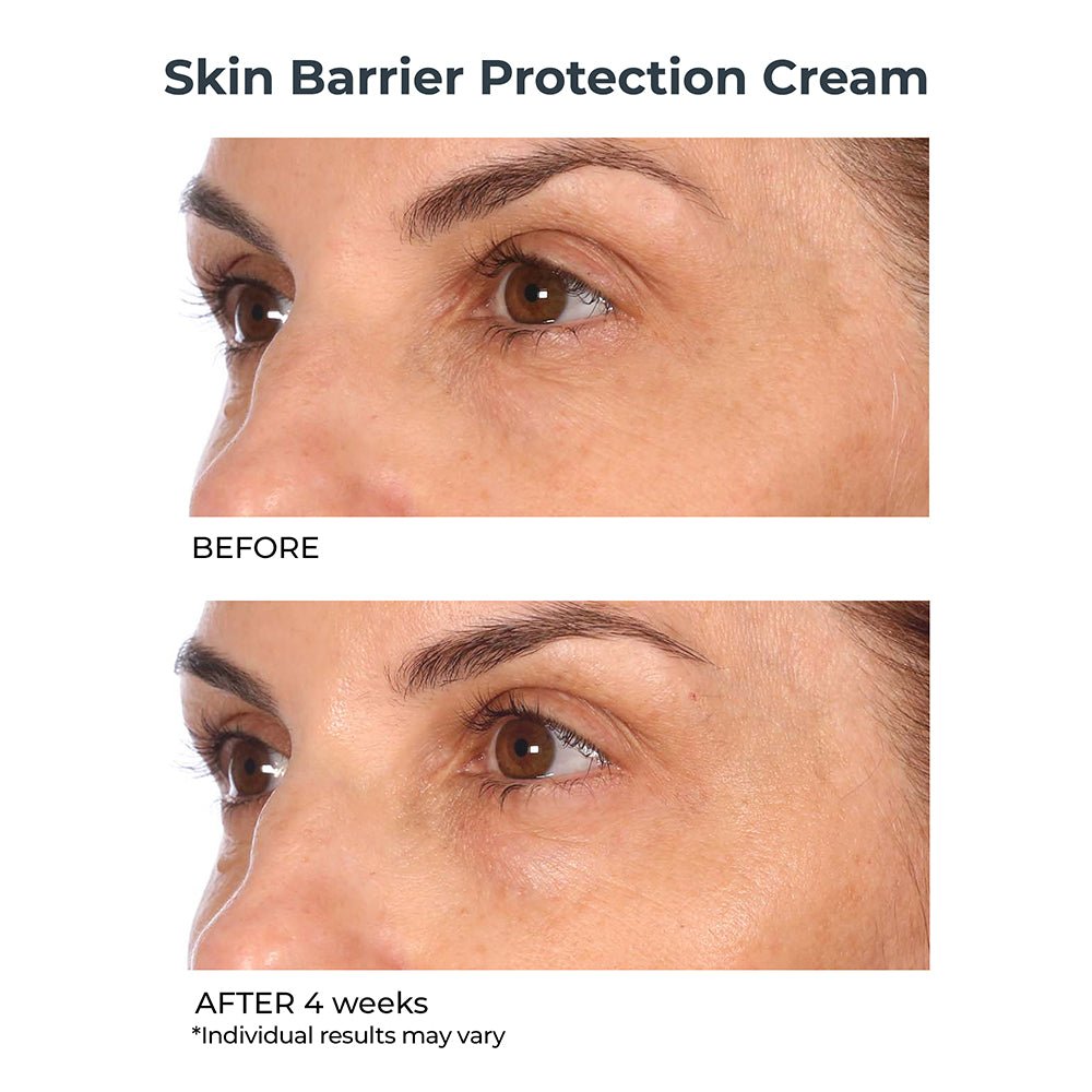 Skin Barrier Protection Cream - NassifMD® Skincare