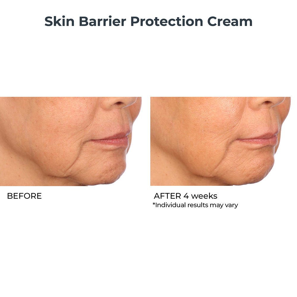 Skin Barrier Protection Cream - NassifMD® Skincare