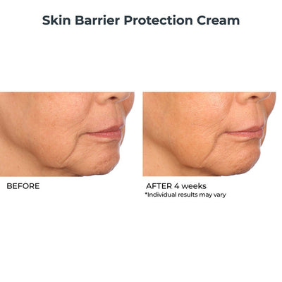 Skin Barrier Protection Cream - NassifMD® Skincare
