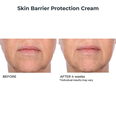 Skin Barrier Protection Cream - NassifMD® Skincare