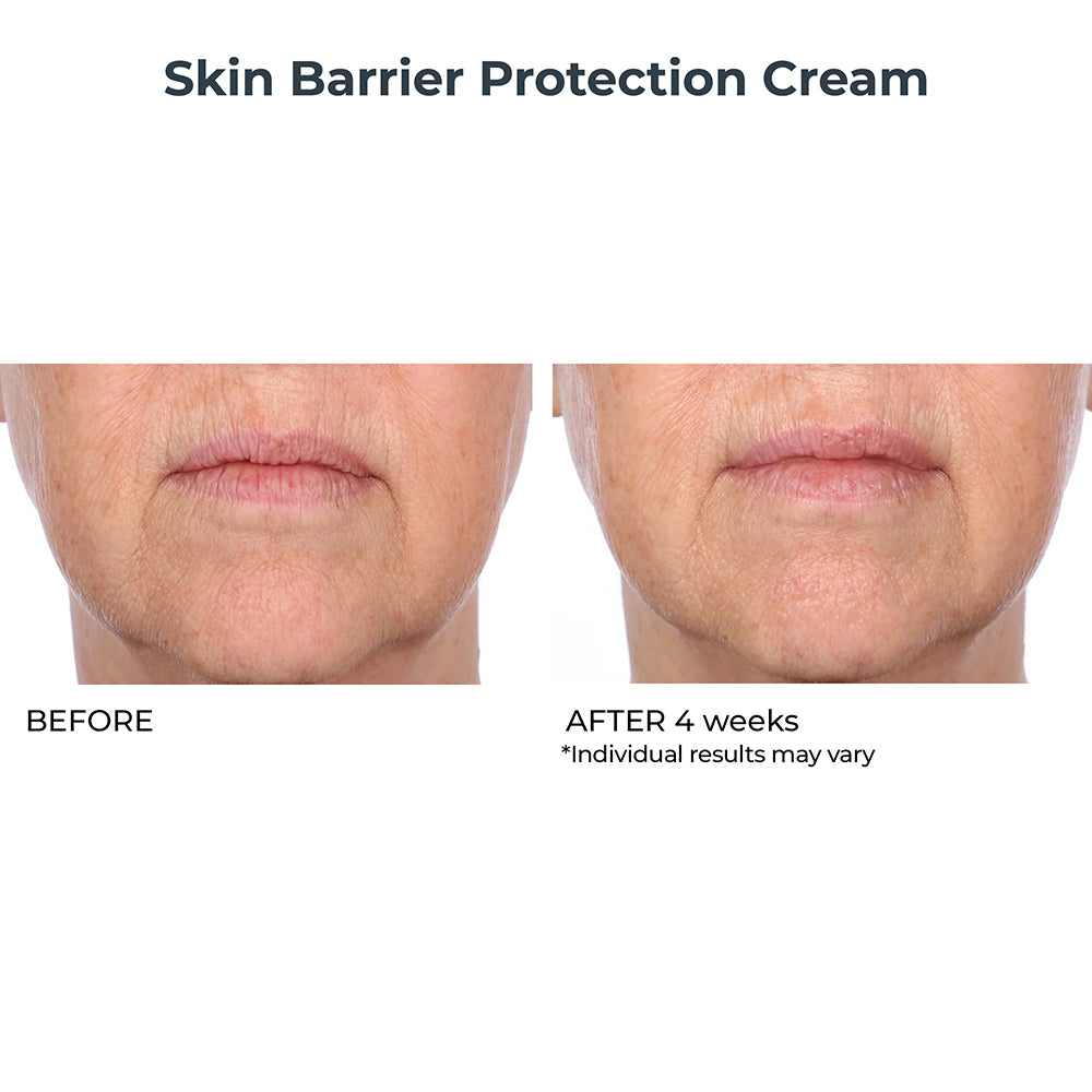 Skin Barrier Protection Cream