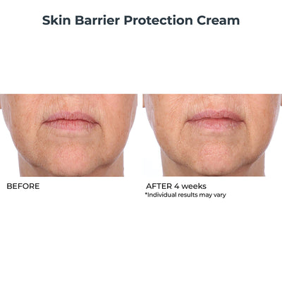 Skin Barrier Protection Cream