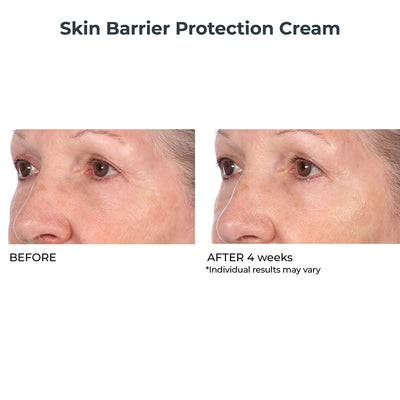 Skin Barrier Protection Cream