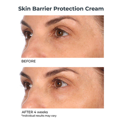 Skin Barrier Protection Cream