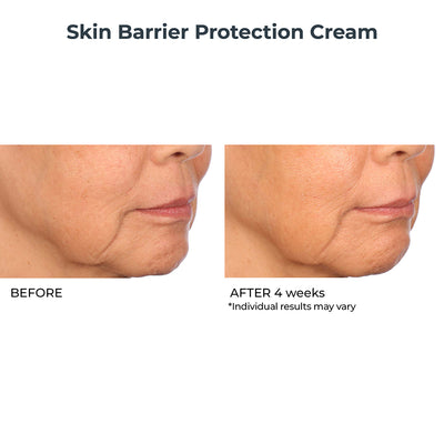 Skin Barrier Protection Cream