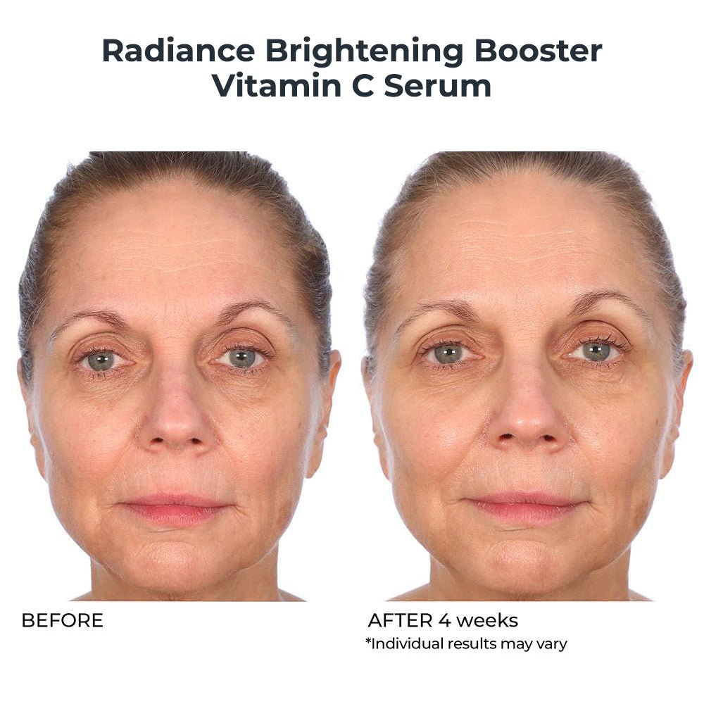 Vitamin C Essentials Duo - NassifMD® Skincare