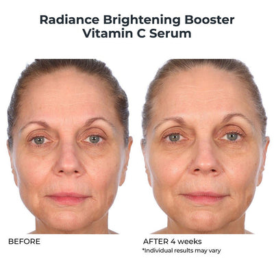 Vitamin C Essentials Duo - NassifMD® Skincare