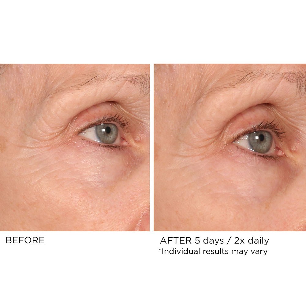 Age Defying Eye Renewal Serum - NassifMD® Skincare