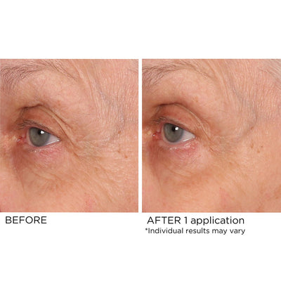Age Defying Eye Renewal Serum - NassifMD® Skincare