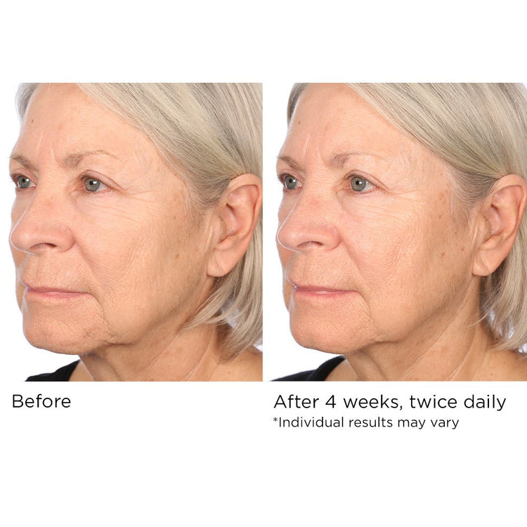 Dr. Nassif Hydro Screen Serum for Face, Neck, and Hand Skin - NassifMD ...