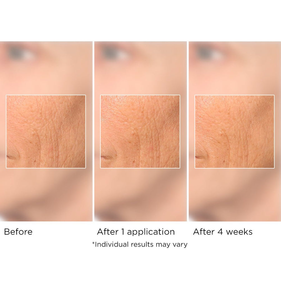 Dr. Nassif Hydro Screen Serum for Face, Neck, and Hand Skin - NassifMD ...