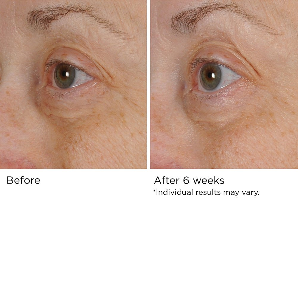 Peri-Orbital Eye Complex - Eye Skin Tightening Cream - NassifMD