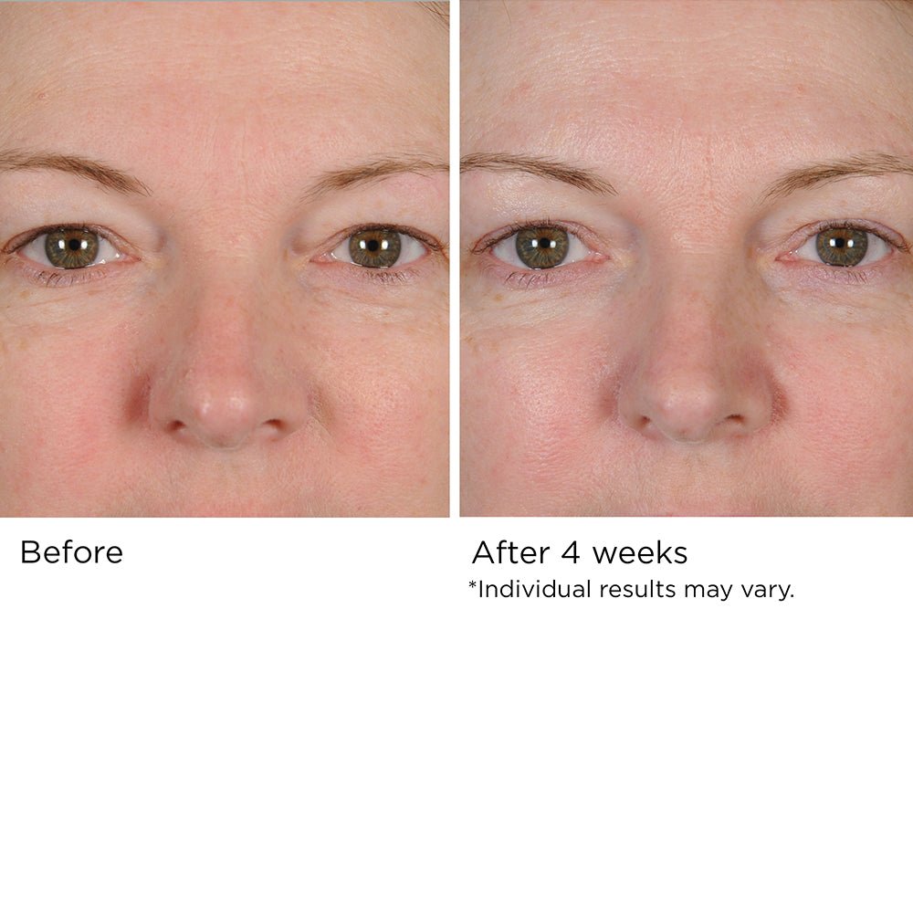 Peri-Orbital Eye Complex - Eye Skin Tightening Cream - NassifMD