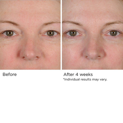 Peri-Orbital Eye Complex - NassifMD® Skincare