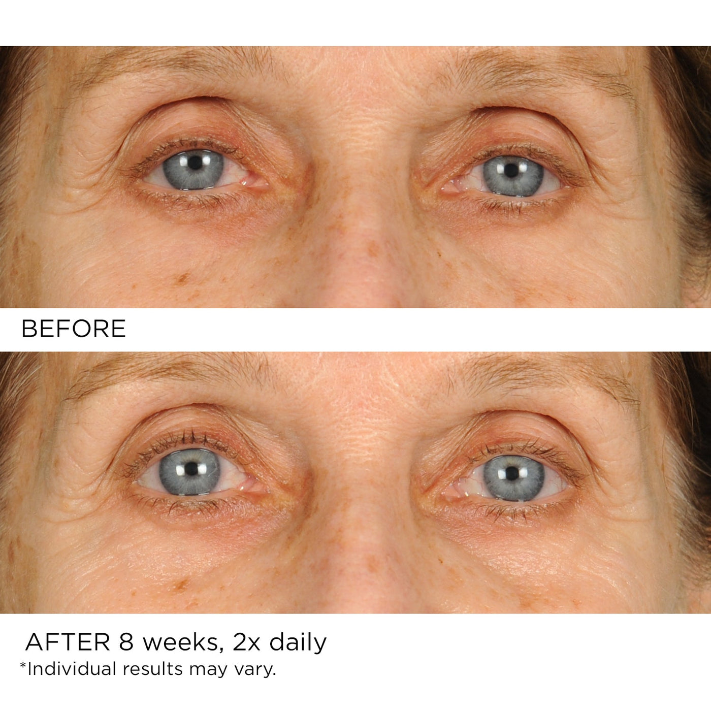 Undereye Anti-Aging Smoother - NassifMD® Skincare
