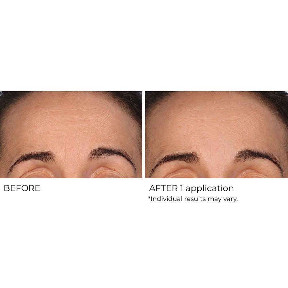 Wrinkle Blur Targeted Treatment - NassifMD® Skincare